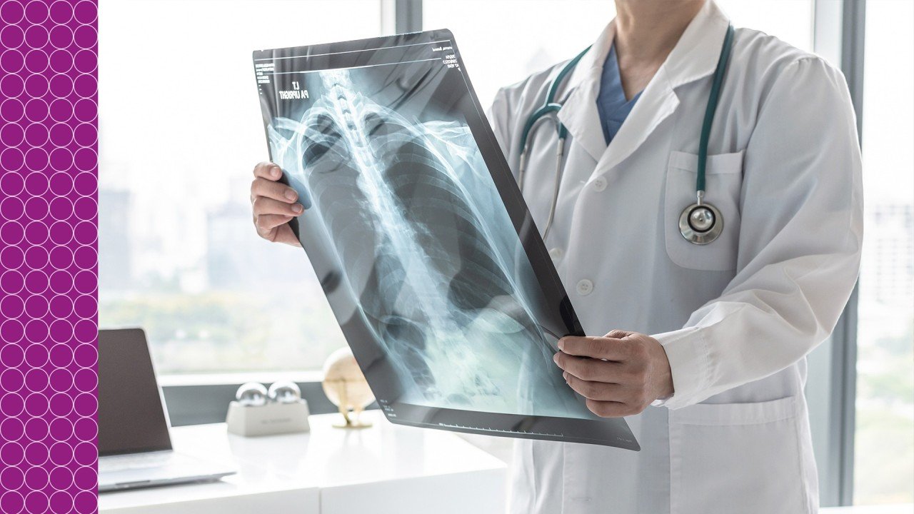 A importância da Rede TB no Combate à Tuberculose
