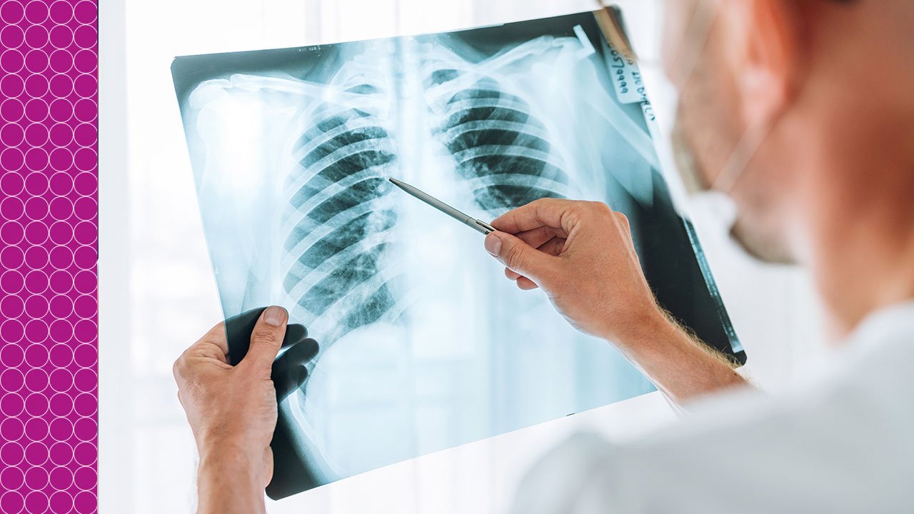 Avanços-no-Combate-à-Tuberculose-no-Brasil--Desafios-e-Oportunidades-para-o-Futuro