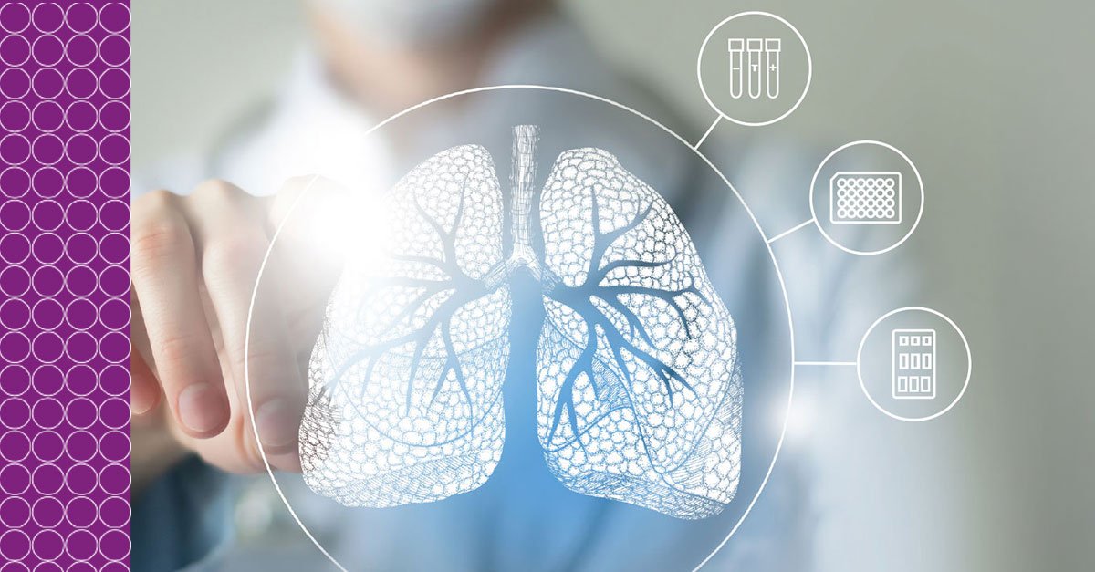 Diagnóstico-da-tuberculose-latente-pela-produção-da-citocina-IP-10
